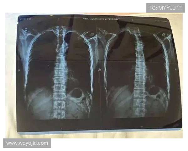 全方位深入解析滑雪技巧装备选择与安全要点及新手进阶实用指南全 全方位深入解析滑雪技巧装备选择与安全要点及新手进阶实用指南全